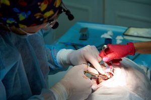 Oral Surgery