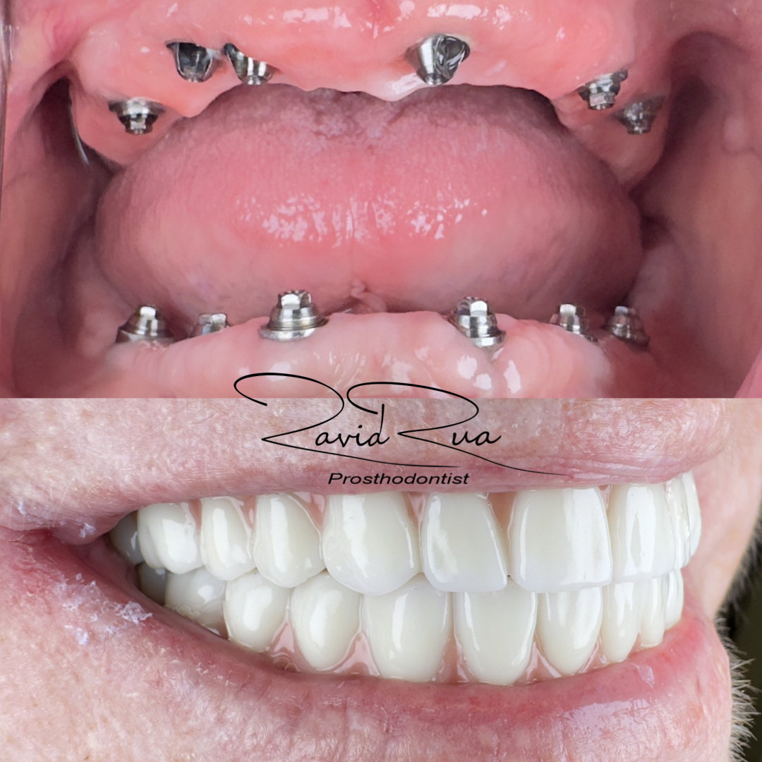 All on 6 Hybrids .002